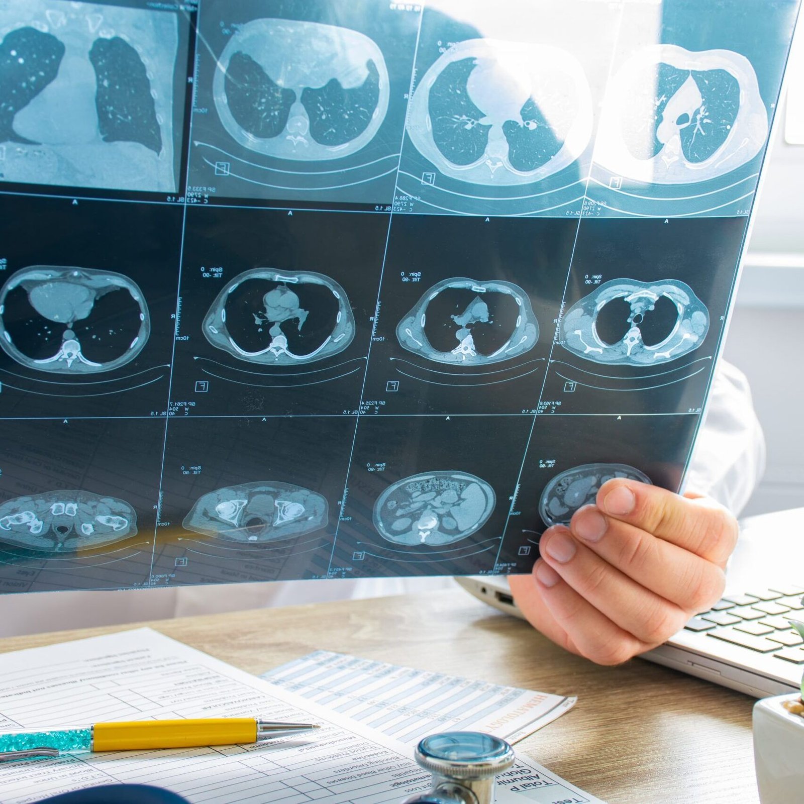 Fotografia de médico analisando Tomografia Computadorizada (TC)