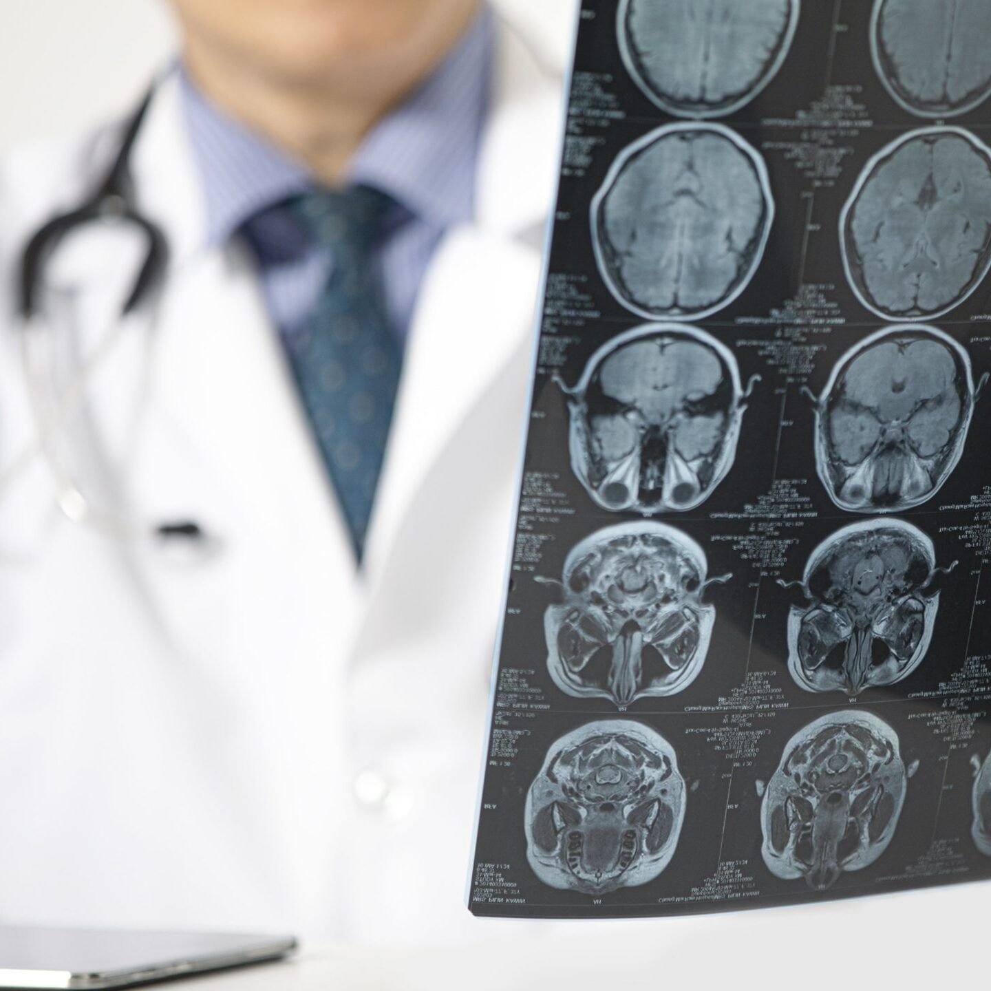 Fotografia de médico analisando Ressonância Magnética